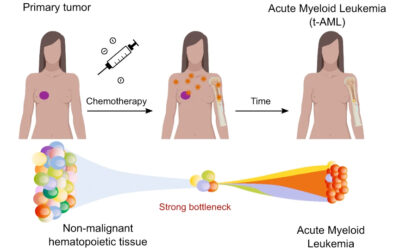 cancer micrometastatico impacto en el tratamiento del paciente
