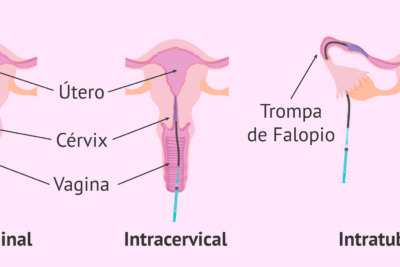 inseminacion artificial proceso y funcionamiento en detalle