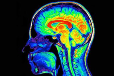 como afecta el abuso de sustancias a la cognicion