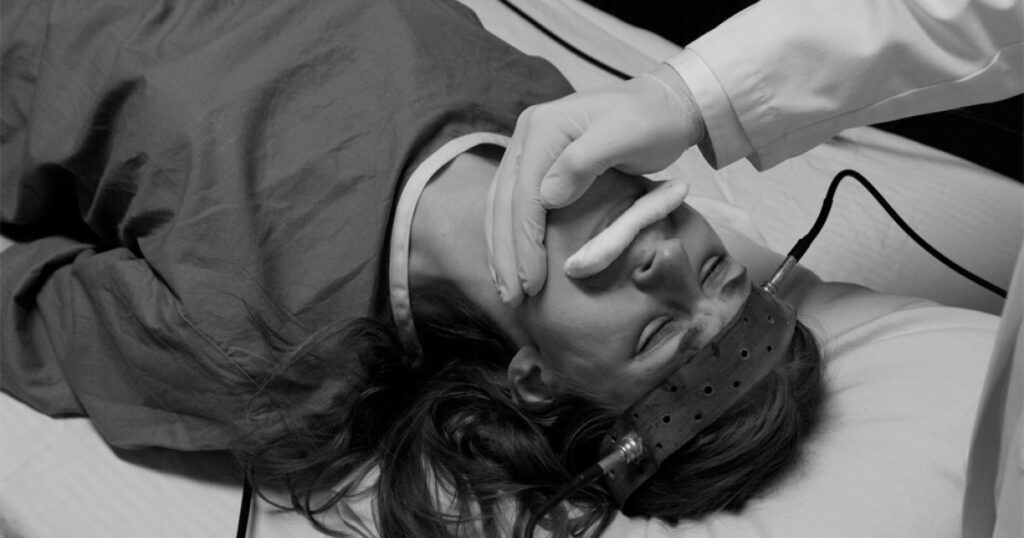 efectos a largo plazo de la terapia electroconvulsiva analisis y hallazgos