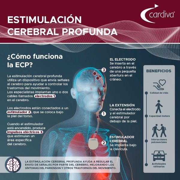 tecnicas de estimulacion cerebral y sus beneficios