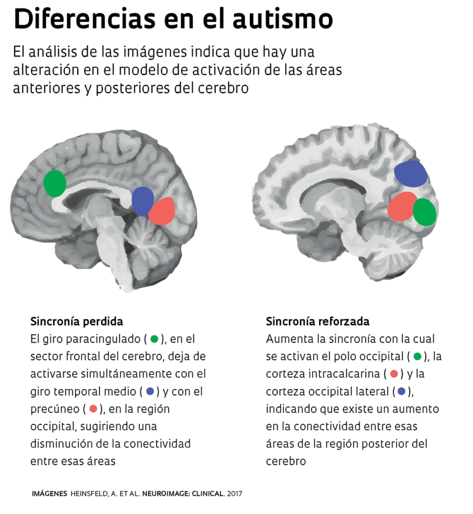 trastornos del espectro autista que sucede a nivel cerebral