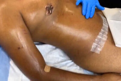 que procedimientos son necesarios despues de una cirugia
