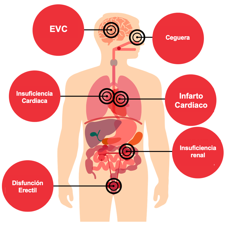 Hipertensión Arterial: Reconociendo los Síntomas 1 hipertension arterial reconociendo los sintomas