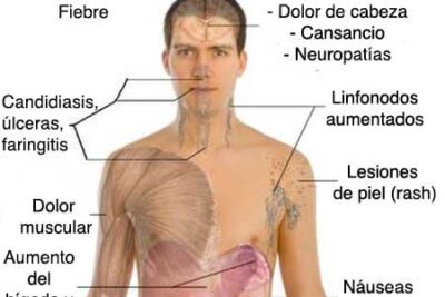 sintomas del vih en hombres guia completa