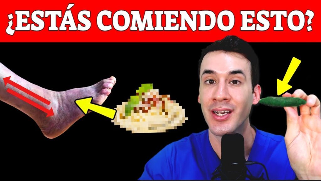 estos 7 alimentos causan varices e insuficiencia venosa los evitas