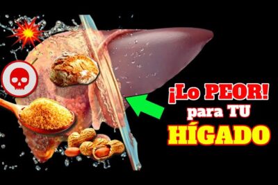 peor alimento la esteatosis hepatica te acecha descubre por que