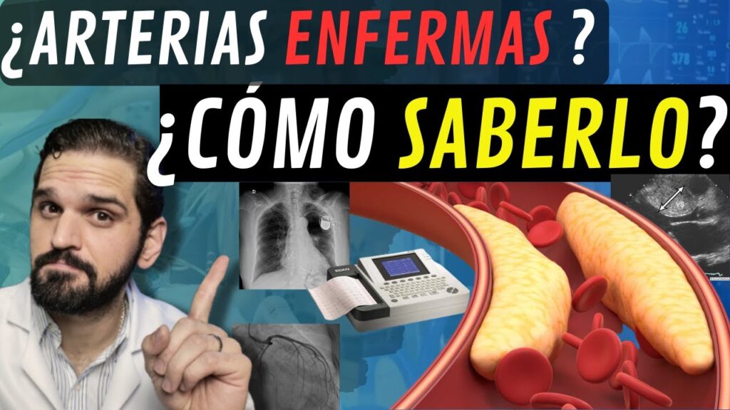 test para detectar arteria tapada metodo simple en casa