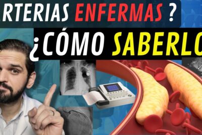test para detectar arteria tapada metodo simple en casa