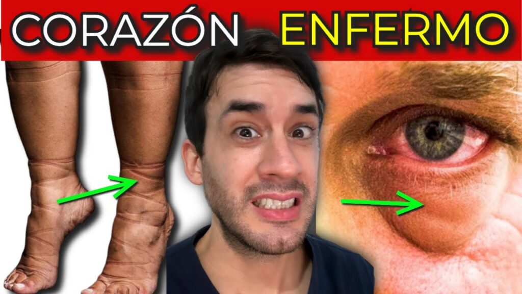 7 sintomas de infarto reconocelos y protege tu corazon