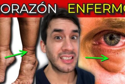 7 sintomas de infarto reconocelos y protege tu corazon