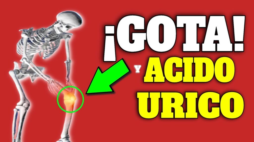 acido urico y gota guia completa para reducir niveles