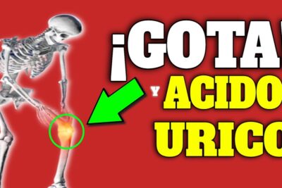 acido urico y gota guia completa para reducir niveles