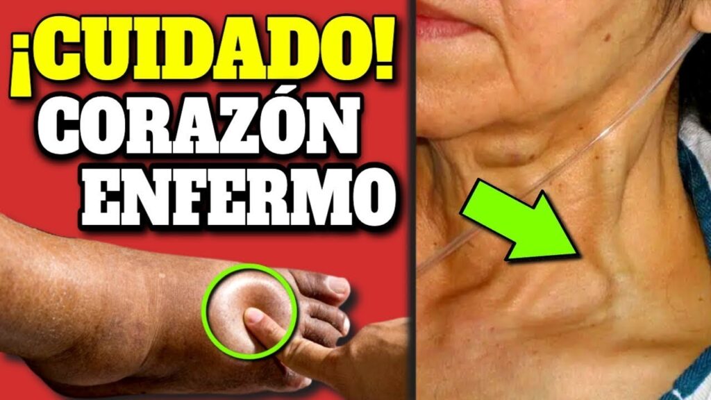 alerta corazon 7 sintomas clave de insuficiencia cardiaca