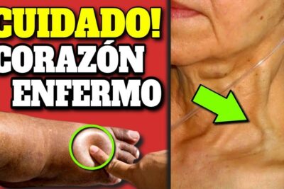 alerta corazon 7 sintomas clave de insuficiencia cardiaca