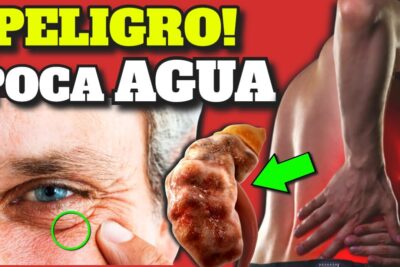 alerta hidratate peligros de la deshidratacion y enfermedades curadas con agua