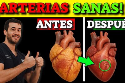 alimentos para arterias limpias guia completa y natural