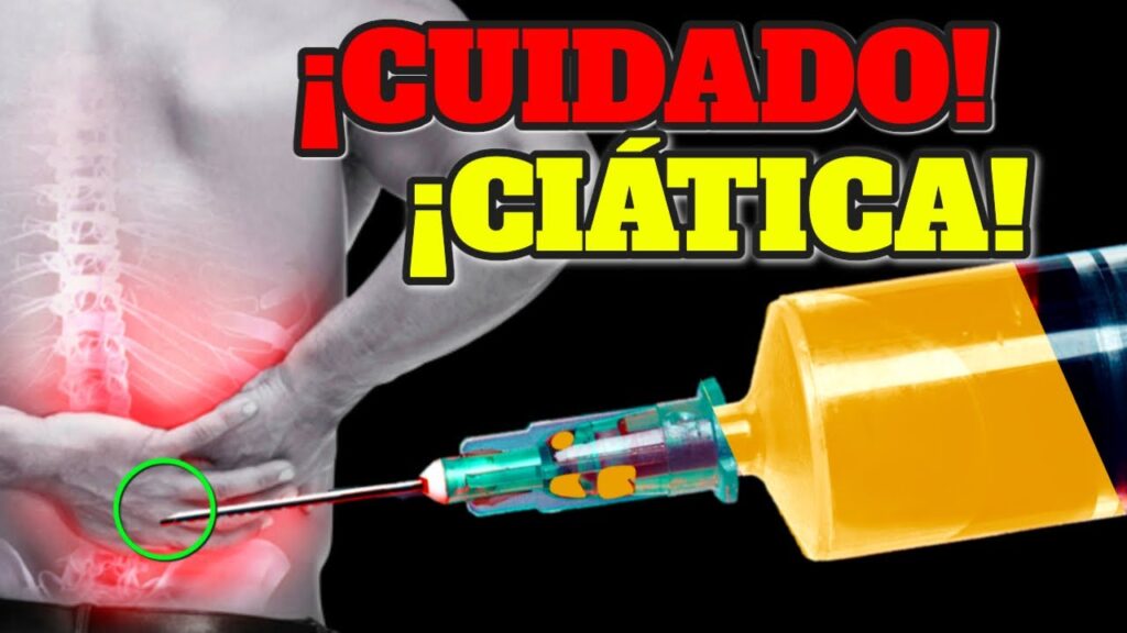 alivio del nervio ciatico ejercicios y tratamientos para una vida sin dolor