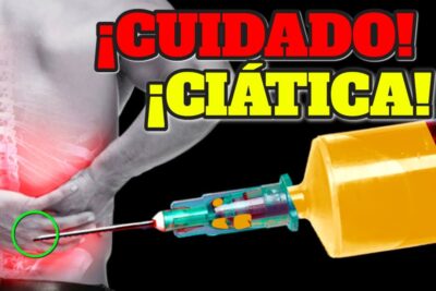 alivio del nervio ciatico ejercicios y tratamientos para una vida sin dolor