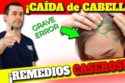 alopecia remedios caseros y tratamientos efectivos