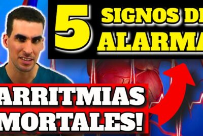 arritmias mortales 5 senales de alerta que debes conocer