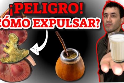 calculos renales guia completa para expulsarlos naturalmente