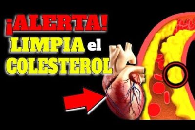 cholesterol alto limpia tus arterias naturalmente sin medicacion