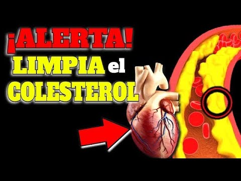 cholesterol alto limpia tus arterias naturalmente sin medicacion