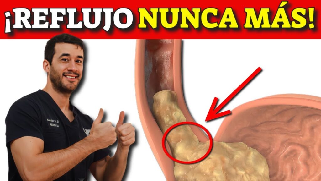 cura reflujo acido guia completa y natural