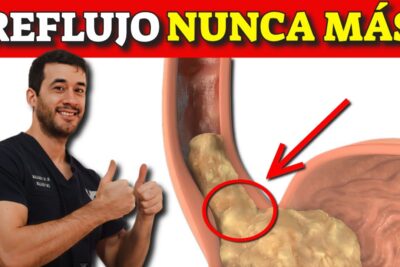 cura reflujo acido guia completa y natural