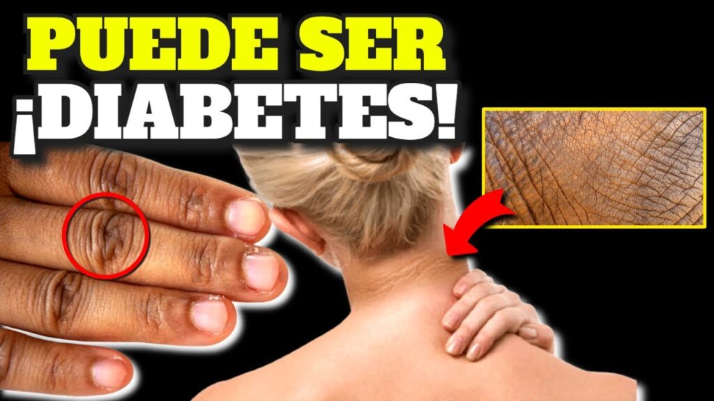diabetes temprana detecta los primeros sintomas y prevencion