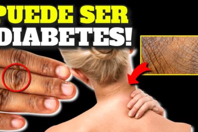 diabetes temprana detecta los primeros sintomas y prevencion