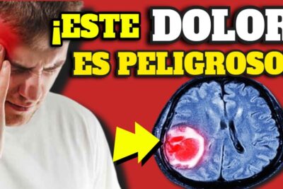 dolor de cabeza senales de alerta y cuando consultar