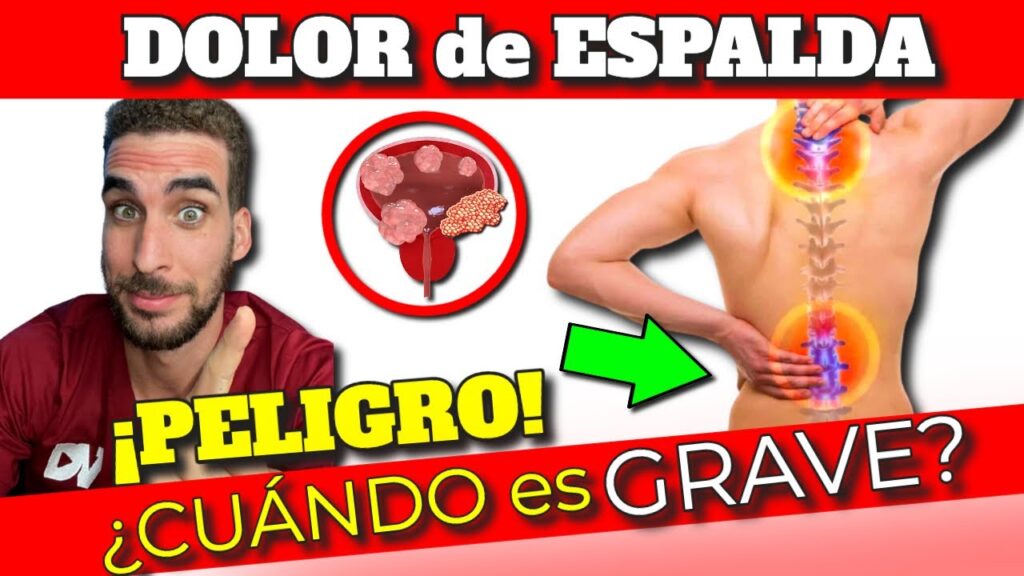 dolor de espalda sintomas serios y cuando consultar