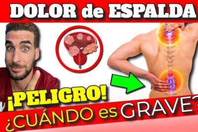 dolor de espalda sintomas serios y cuando consultar