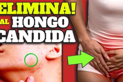 elimina la candida para siempre guia completa y efectiva