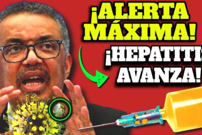 hepatitis aguda severa alerta mundial y posibles causas
