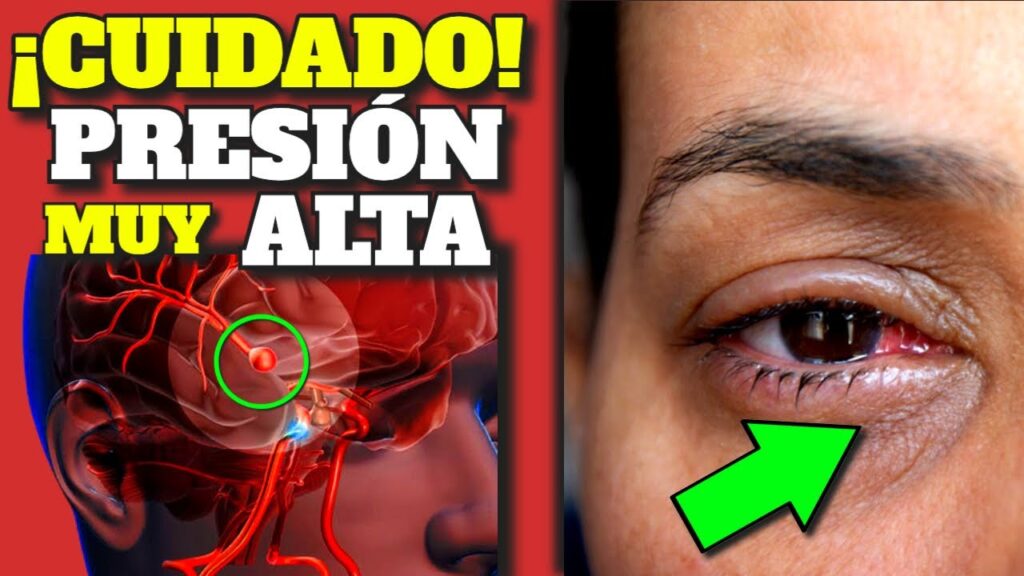 hipertension arterial baja tu presion sin medicacion
