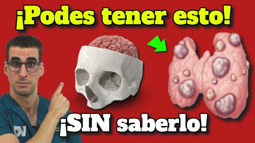 Hipotiroidismo: 7 Síntomas Clave, Prevención y Tratamiento 1 hipotiroidismo 7 sintomas clave prevencion y tratamiento