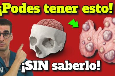 hipotiroidismo 7 sintomas clave prevencion y tratamiento