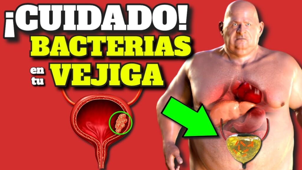 infecciones urinarias sintomas tratamiento y prevencion