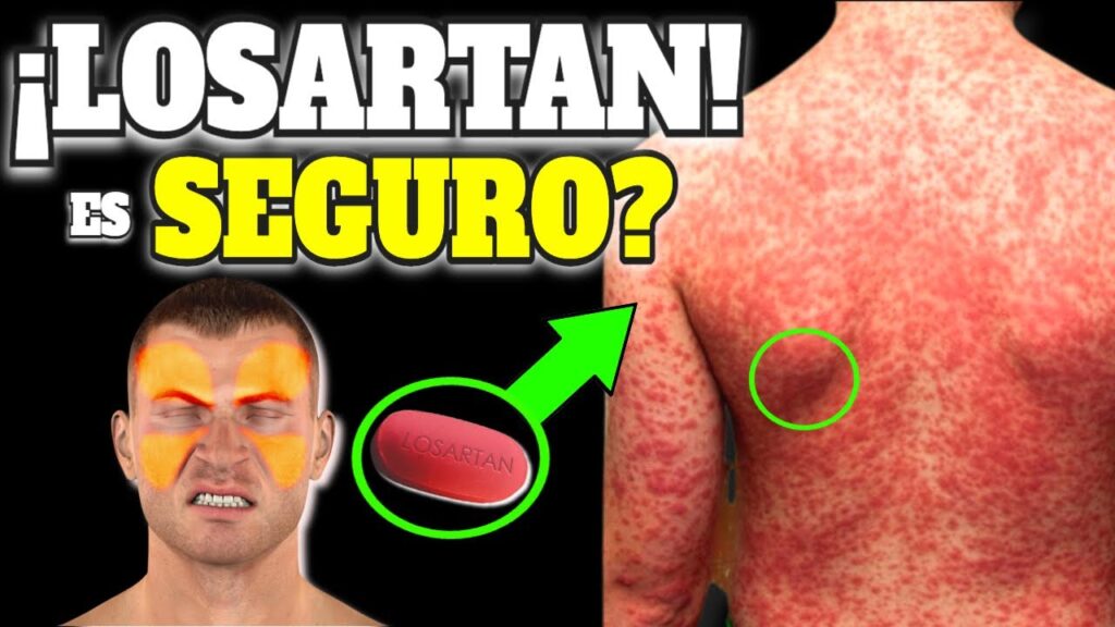 losartan riesgos beneficios y uso seguro