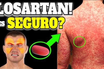 losartan riesgos beneficios y uso seguro