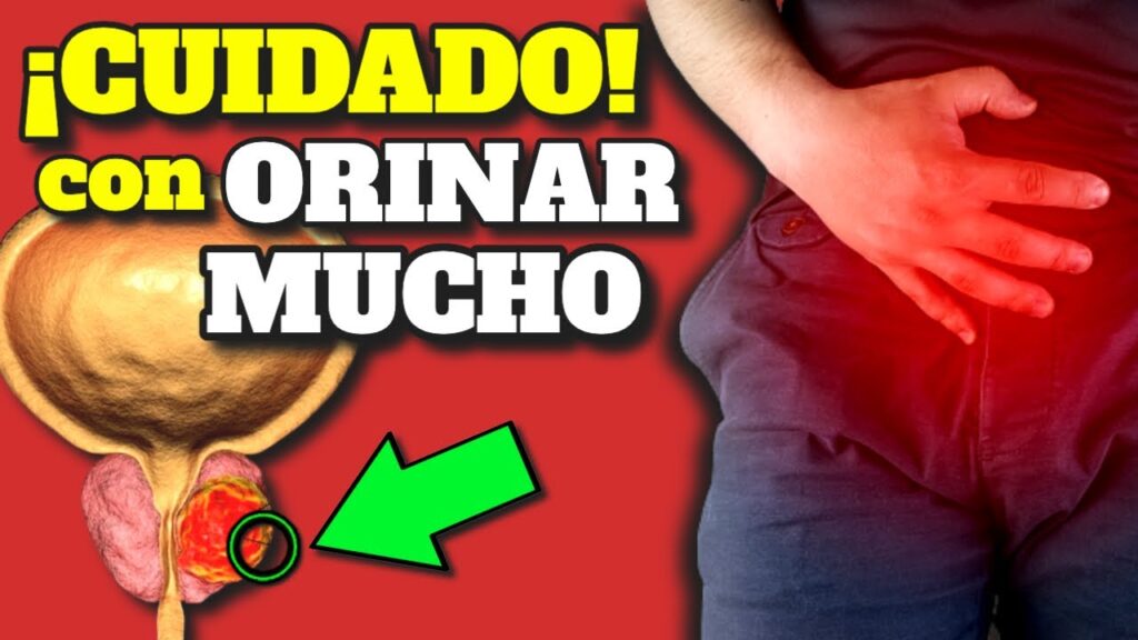 miccion excesiva causas riesgos y como controlarla