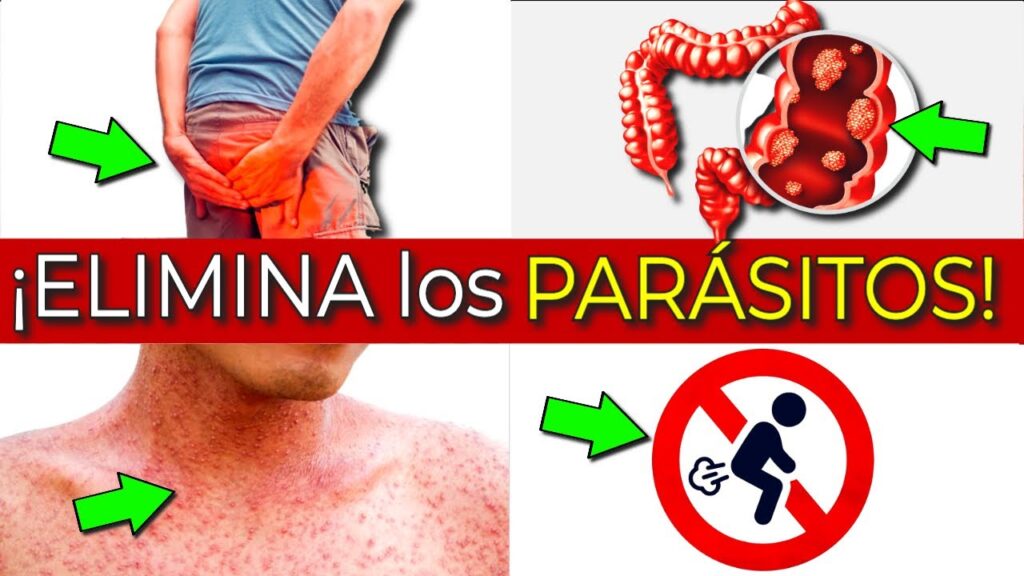 parasitos intestinales sintomas eliminacion rapida y prevencion