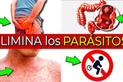 parasitos intestinales sintomas eliminacion rapida y prevencion