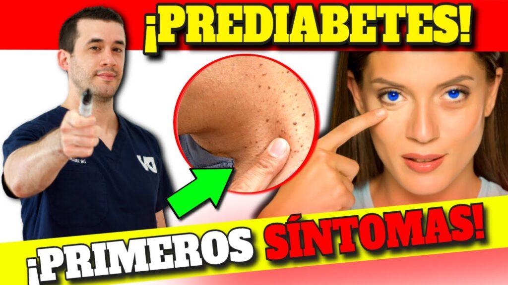 prediabetes e insulino resistencia senales de alerta