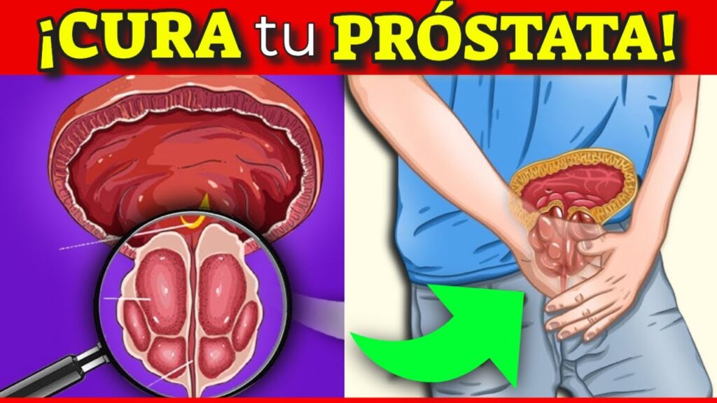 remedios naturales prostata reduce su tamano