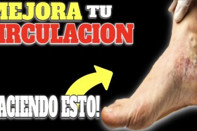 varices y mala circulacion ejercicios efectivos