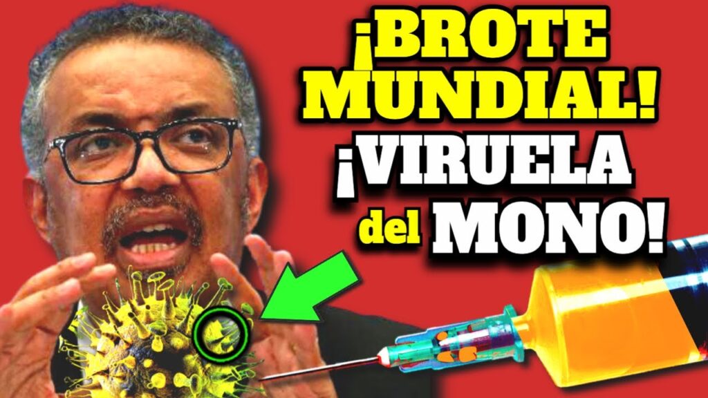 viruela del mono alerta sanitaria en europa y america